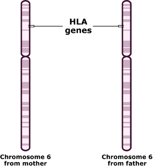 Illustration showing HLA genes in chrommosome 6 from mother and chromosome 6 in father. 