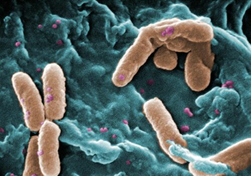 A scanning electron micrograph (SEM) of a number of Pseudomonas aeruginosa bacteria.