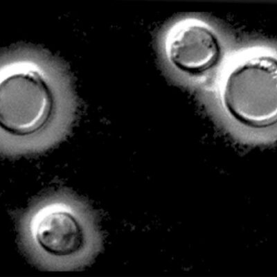 An image of Cryptococcus neoformans