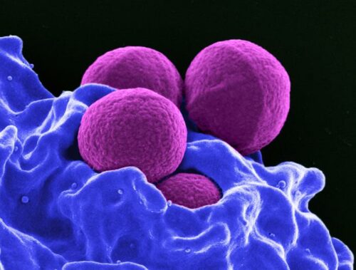 Electron microscope image of Staphylococcus aureus (MRSA) bacteria, depicted as four magenta-colored spheres being phagocytized by a blue-colored human white blood cell.