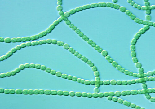 Chains of Cyanobacteria (blue-green algae).