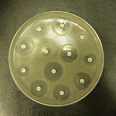 Thin wafers containing antibiotic have been placed on an agar plate growing bacteria.