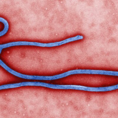 Colorized transmission electron micrograph of an ebola virus virion.
