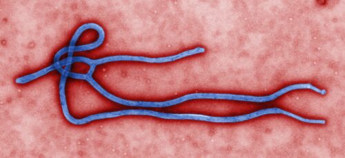 Colorized transmission electron micrograph of an ebola virus virion.