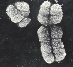 Human Y chromosome on the left; X chromosome on the right.