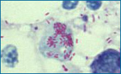 A cell infected with Rickettsia