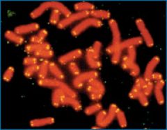 Image of human chromosomes visualized in orange.