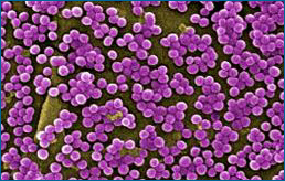 Micrograph of MSRA (visualized as purple).