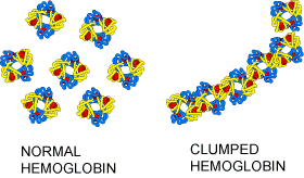 Normal hemoglobin in normal red blood cell and clumped hemoglobin in sickle-shaped red blood cell
