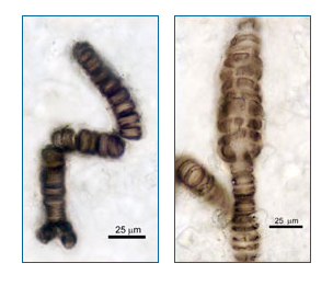 Microfossils showing multiple cells as part of a single organism, a red algae.