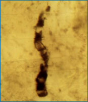 Dark, worm-like shape on a yellow background
