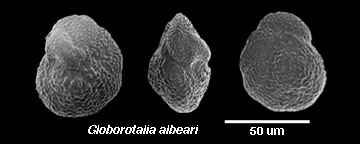 Foraminiferan micrograph of Globorotalia albeari