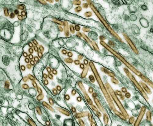 Microscopic image showing rod-shaped and spherical virus particles in green and brown colors, dispersed among various cell structures. The background is mostly white, highlighting the contrasting shapes and textures of the particles.